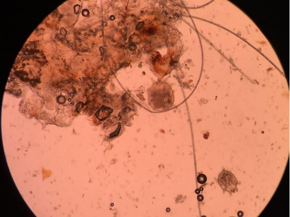 显微镜下的螨虫卵图片图片